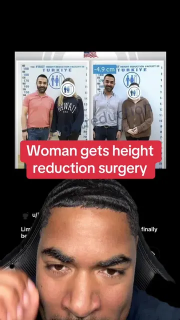 What do you think about this??🤔🤔#height #tall #short #surgery #turkey 
