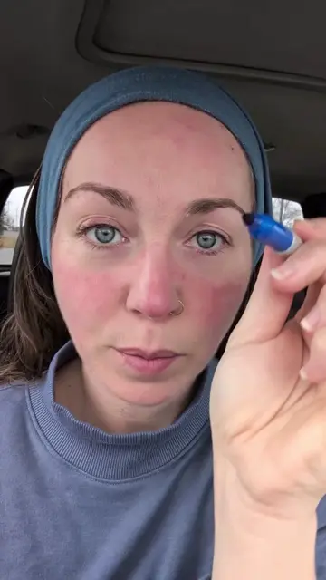 Will sharpie come off my face using the Dr Melaxin peel shot?? #drmelaxin #peels