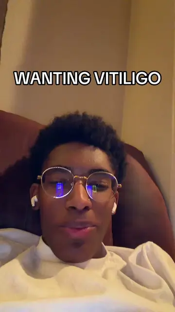 it does look fye tho ngl😭😭😭 #fyp #vitiligo #foryouoage #howto #braces 
