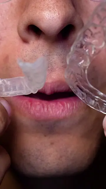 That’s bad 😭 #gaptaincrunch #viral #fyp #teethwhitening #retainer 