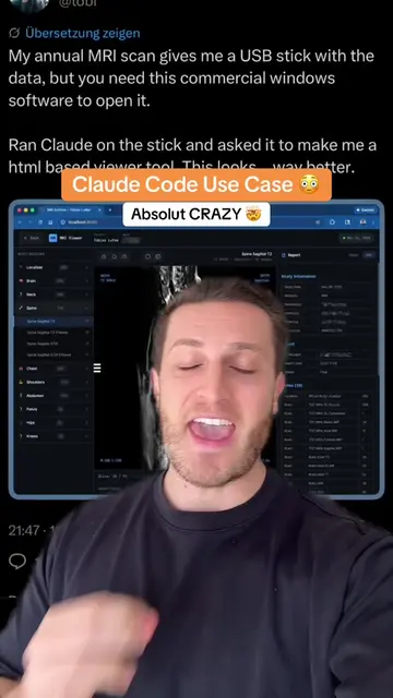 Claude Code Use Case einfach völlig Crazy 🤯 #claude #ai #claudecode #aitool #ai