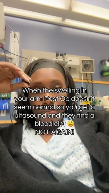 Please please if something doesn’t feel right go and get it checked!! The swelli