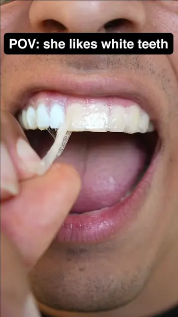 She approves 🥹 #viral #fyp #braces #gaptaincrunch #teethwhitening 