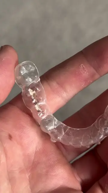 These tablets actually clean my retainers so well #retainercleaner #dentaltips #