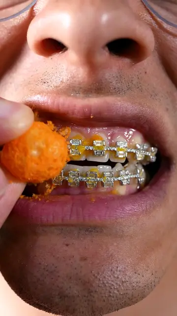 How!? 😳 #gaptaincrunch #fyp #viral #braces #TikTokShopCreatorPicks 