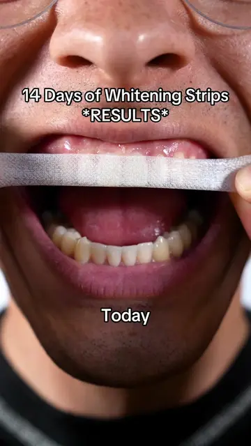 They were so yellow 😳 #gaptaincrunch #fyp #viral #teethwhitening #TikTokShopCre