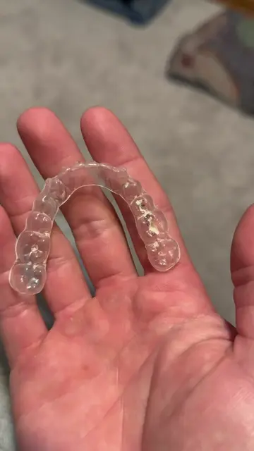 I wish I found these retainer cleaning tablets sooner #retainercleaner #dentalti