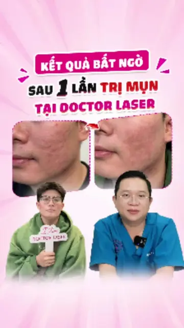 KẾT QUẢ BẤT NGỜ SAU 1 LẦN TRỊ MỤN TẠI DOCTOR LASER #mụn #điềutrịmụn #lamdep #bsl