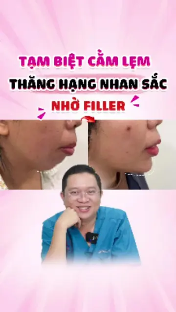 TẠM BIỆT CẰM LẸM THĂNG HẠNG NHAN SẮC NHỜ FILLER #filler #tiemha #lamdep #doctorl