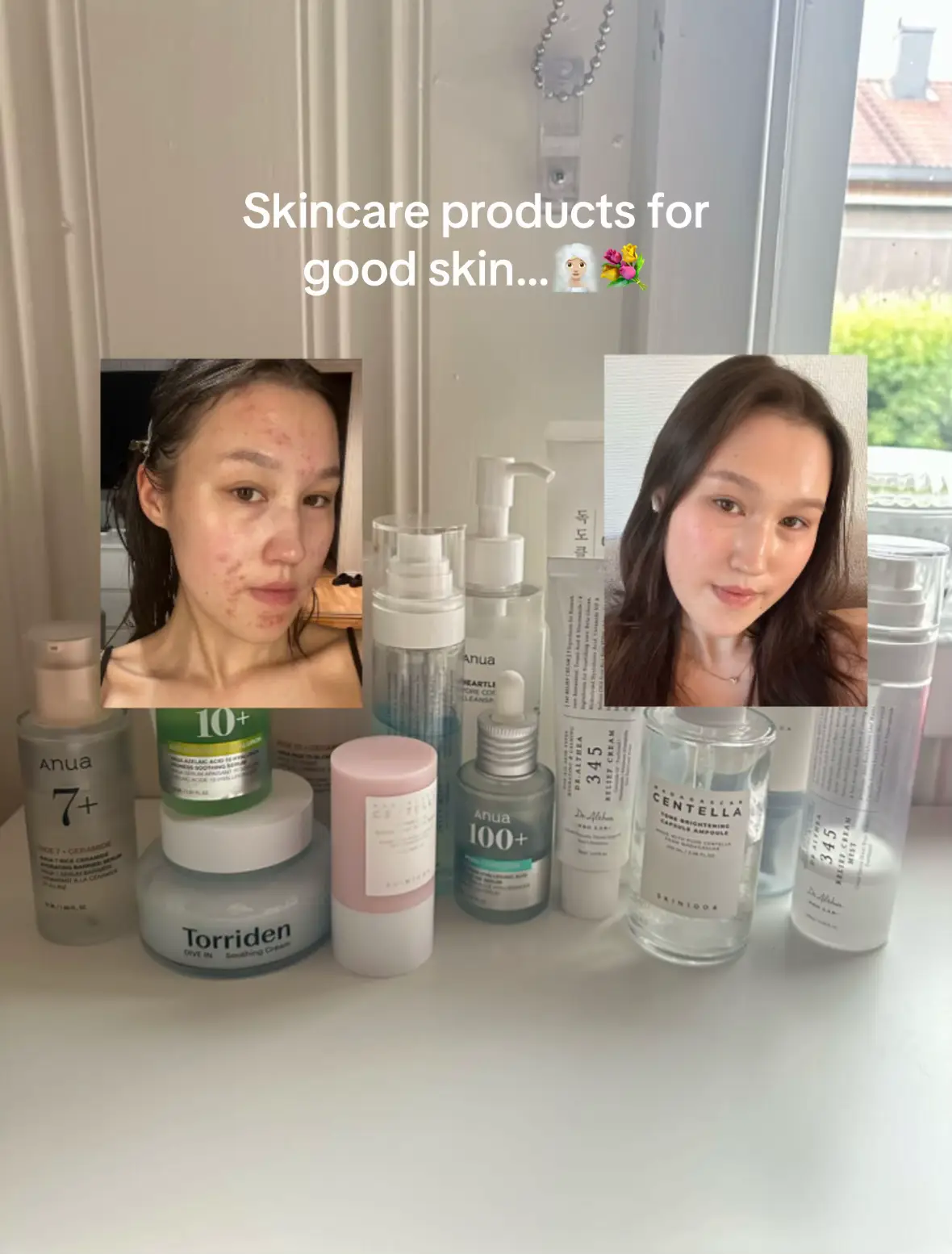 Some of my top favs products that helped my skin!🫶🏻🤍You can get them on YesSt