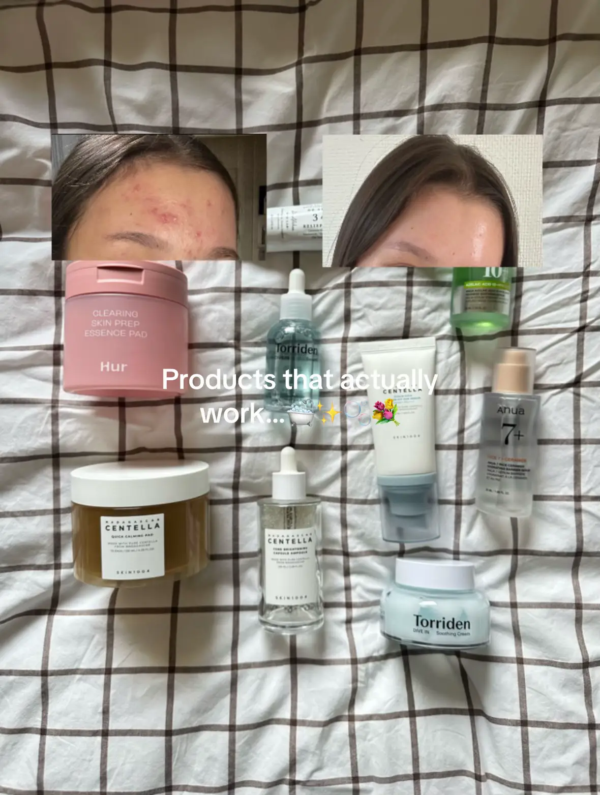 These are some products that actually works in my opinion!🤍✨#acne #clearskin #k