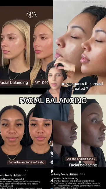 If you knew how many facial balancing transformation videos I have watched …. 👀