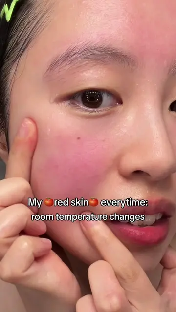 AD #mamonde_partner Summer must have for  Anyone with redness-prone or overheate