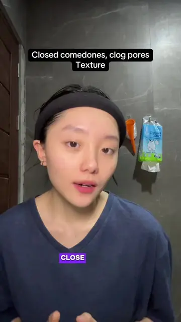 Ga semua skin concern jawabannya "basic skincare"  Kalo kulit udah pake basic sk