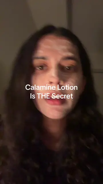 At this point calamine lotion is my emotional support skincare product 😭 #skinc