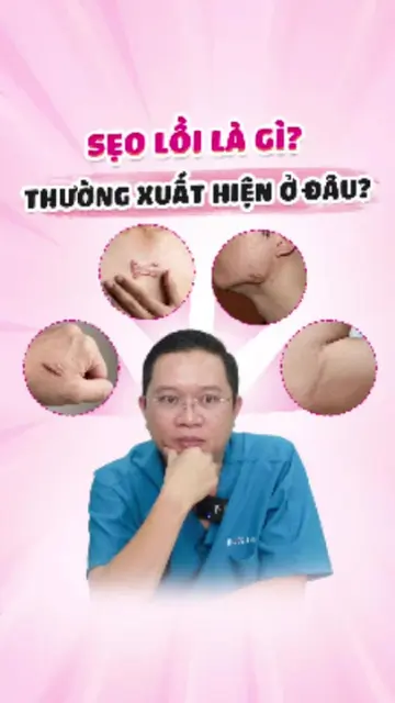 SẸO LỒI LÀ GÌ VÀ THƯỜNG XUẤT HIỆN Ở ĐÂU? #sẹo #sẹolồi #doctorlaser #bsluong 