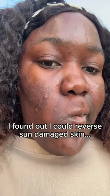 After years of sun damage, I’m finally seeing real changes. ✨ Dark spots, uneven