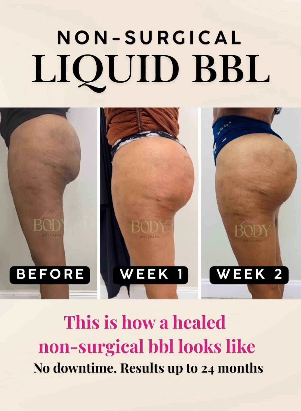 No going under the knife, a very non-invasive procedure. This is what healed loo