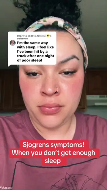 Replying to @Midlife Autistic 🌻 when you don’t get enough sleep with sjogrens. 