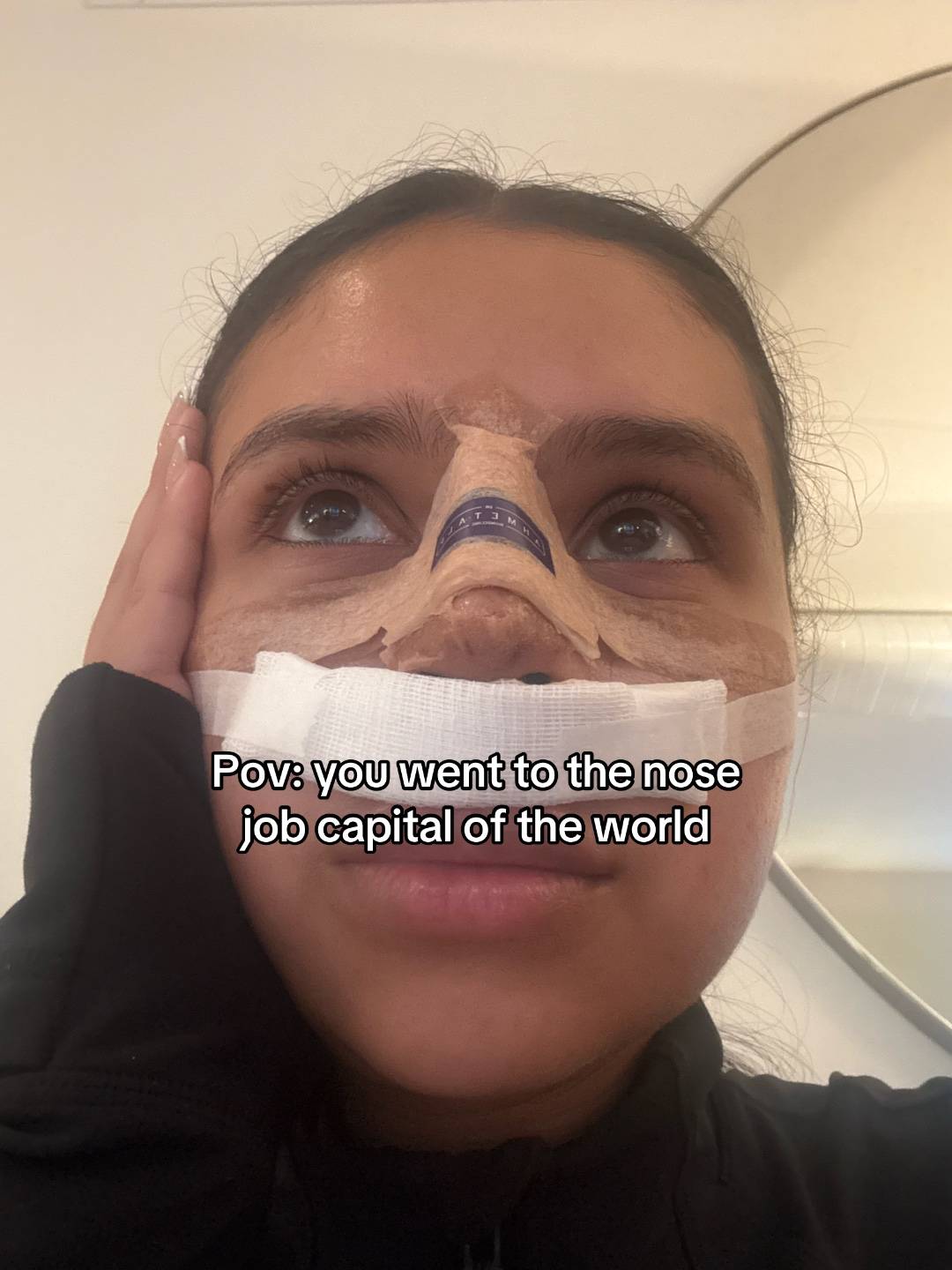 Shes so cutesy @Op. Dr. Ahmet Alp 🥹 #turkey🇹🇷 #nosejob #nosejobturkey #postop