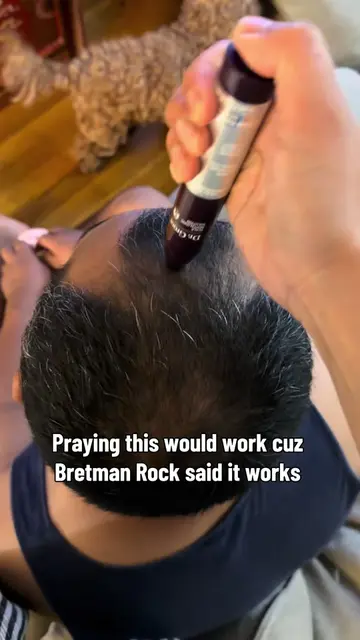 @Dr. Groot Hair cuz @bretmanrock never lies and we trust him #drgroot #hairgrowt