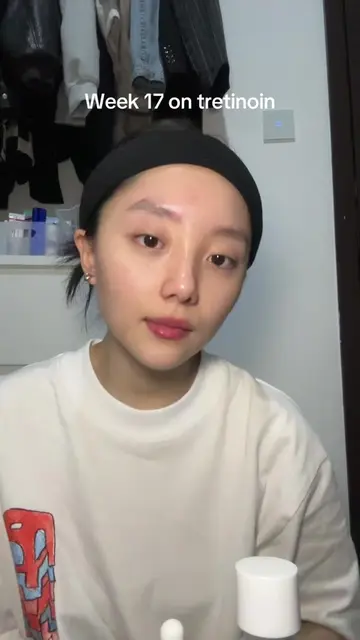 Week 17 - (Tretinoin Journey) finally aku udh bisa pake tretinoin di step pertam
