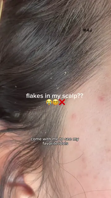 my day 1 @head&shoulders gives me the perfect scalp reset every time 🧼🚿🧘‍♀️ i