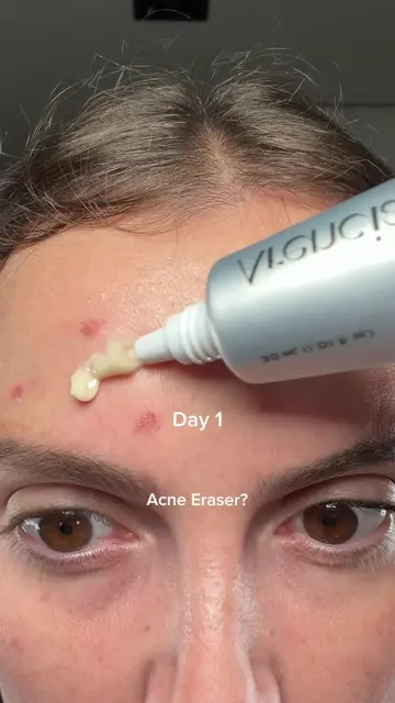 My recent skincare update 🩶 Arencia Eraser Shot 💗 Grab yours now during Amazon