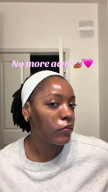 I’m finally in such a good place with my skin, and it definitely didn’t happen o