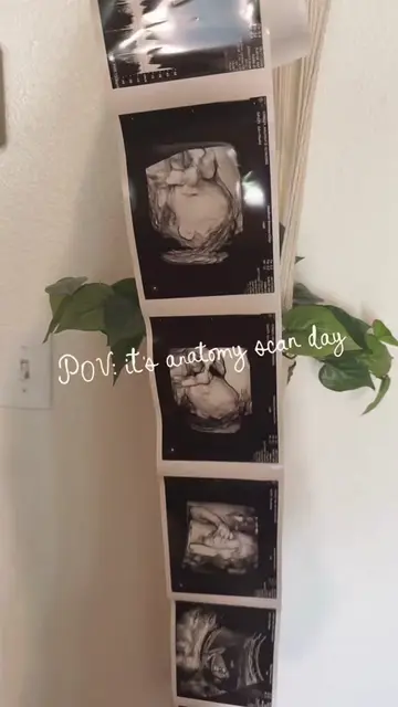 Cannot believe how big he has gotten! 🥹🤎 #fyp #pregnant #babyboy #expecting #a