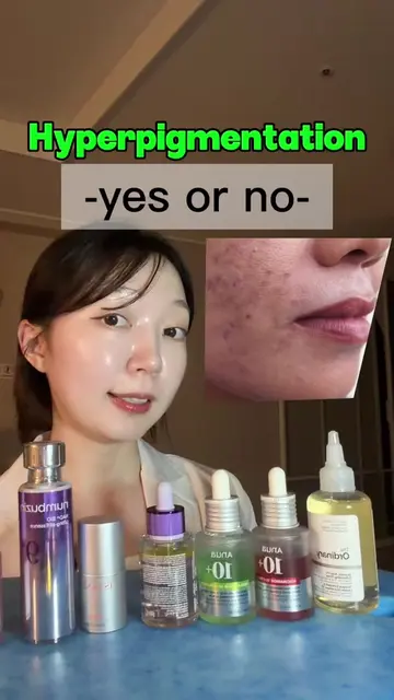Yes or no for hyperpigmentation 1. Azelaic acid✅ 2. Niacinamide✅ 3. Vitamin C❌ 4