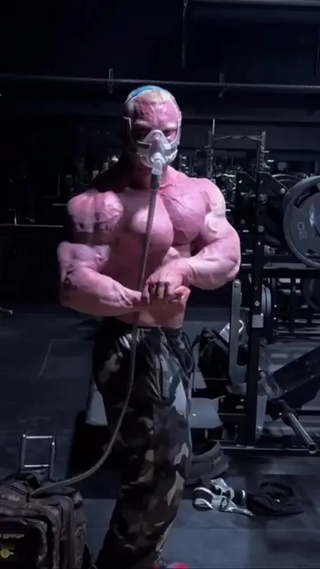 Bodybuilders Took It Way Too Far #Bodybuilding #Hulk #Synthol #Fitness #Gym #Tra