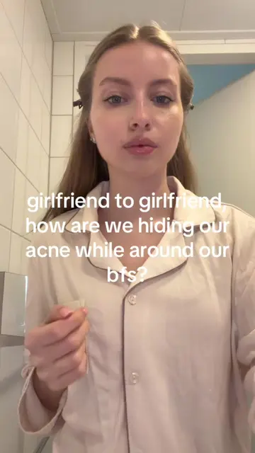 let’s give each other our best tips girlies!! #clearskin #skintips #acnetreatmen