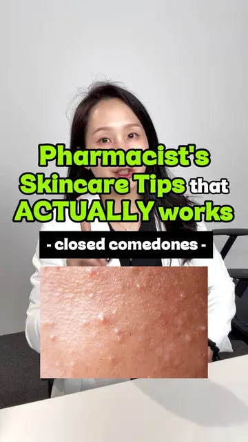 Can't pop those tiny white bumps? They may be closed comedones. 🤍 The key isn't