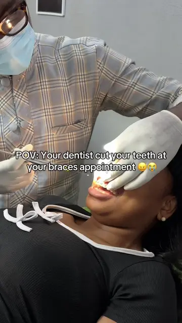 Would you do this 🥲 #braces #bracesjourney #bracescolors 