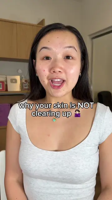 Be honest... which one are you guilty of? 👀  #acne #acnetips #acnetreatment #cl