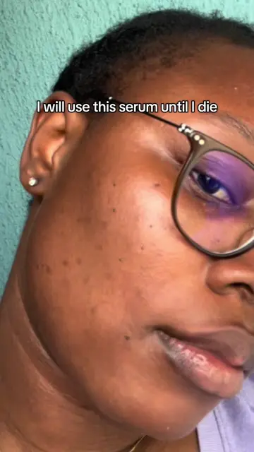 When something works for your skin, you just know 🤭✨ #GlowUp #skincarelovers🥰�