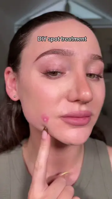 Spot treatment hack using 🧊+🧂+🩹= ✅ #spottreatment #skintips 