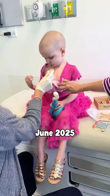 Cam started chemotherapy in October of 2024 and lost her hair that following Feb