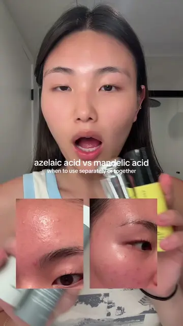 yes, you can use mandelic & azelaic acid together BUT ONLY when your skin barrie