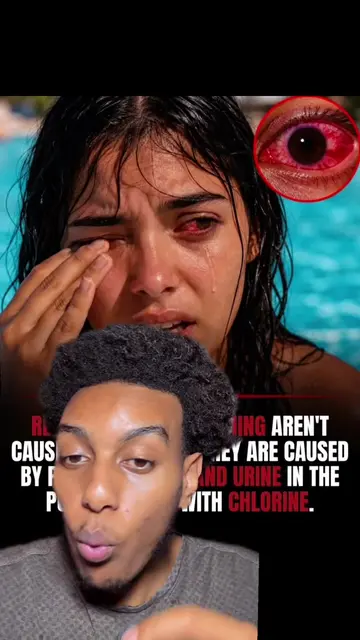 You will never catch me on a public pool😭