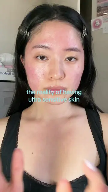 was literally fighting for my life 😭😭  #sensitiveskin #rosacea #rosaceatype2 #