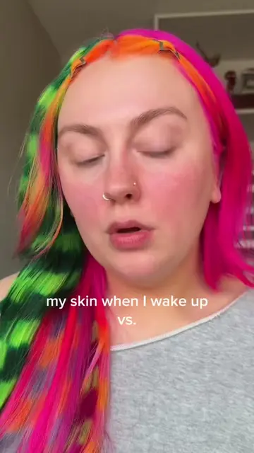 the proof is in the Rescue Balm +Red Correct👏🤩 #skincaretips #redness #colorco