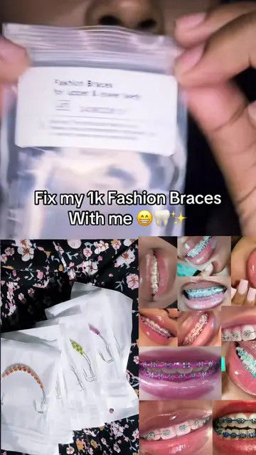 Installing my ₦8K fashion braces! 💖 Available for nationwide delivery. DM to or