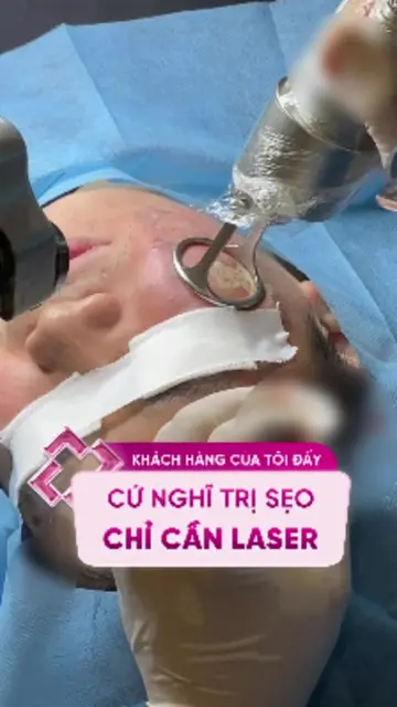 Khách hàng của tôi đấy… cứ nghĩ trị sẹo chỉ cần laser là đủ #sẹo #sẹorỗ #doctorl