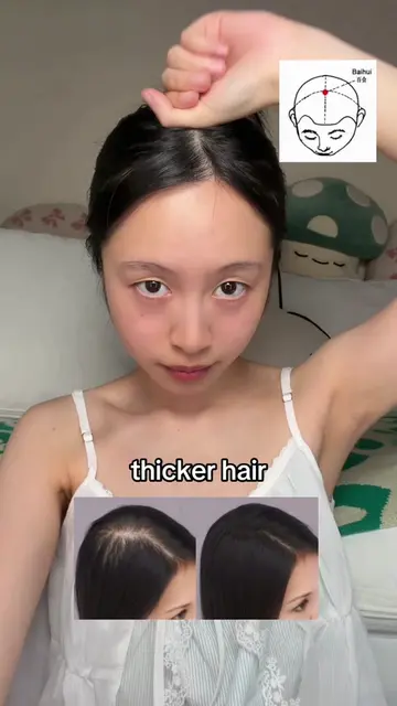 Easy daily routine for hair volume, shiny hair, and receding hairline✨ #headmass