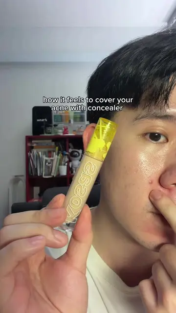 Covering acne with makeup 😭🫪 #acneproneskin #acneproblems #acne #concealer 