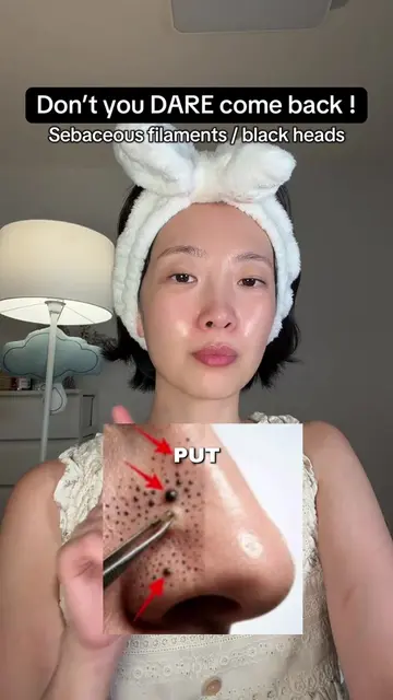 Let’s all write it down 🫡 Thank you @Unleashia Global 💕 AD #blackhead #pores #
