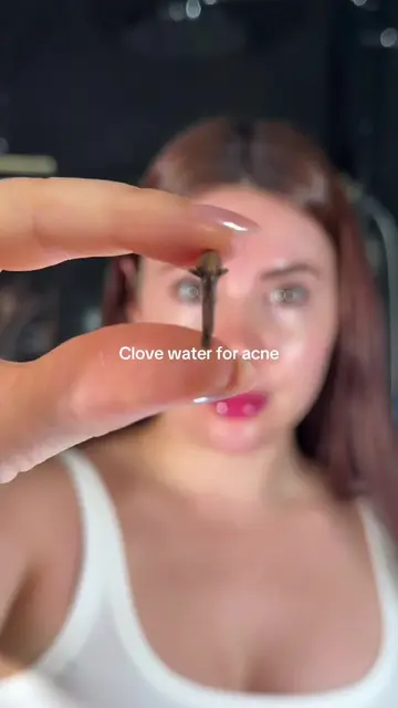 Clove water for acne ✨ #clovewater #clovemist #diyskincare #hyperpigmentation 