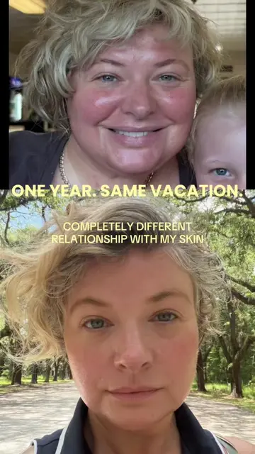 These photos were taken almost exactly one year apart on our family vacation. La